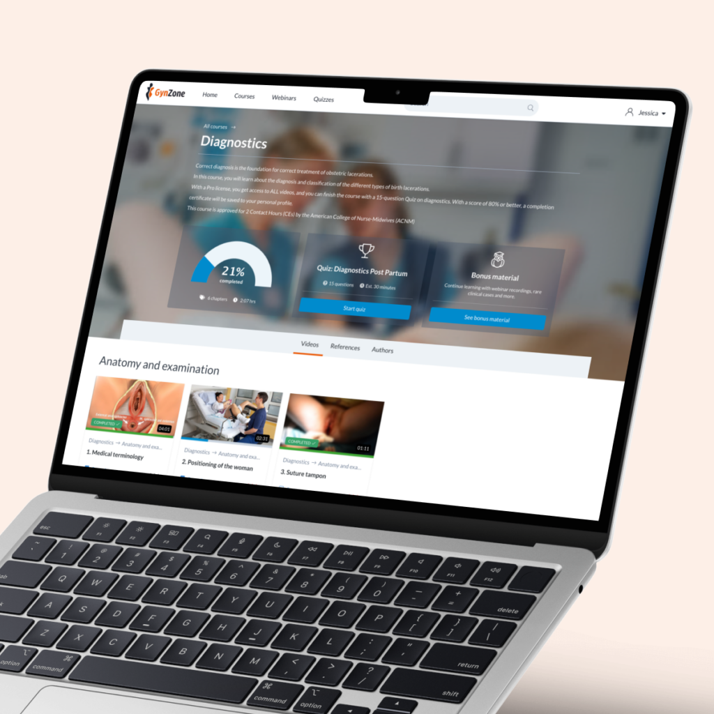 GynZone: Global e-læring med fokus på kvinders efterfødselskrop